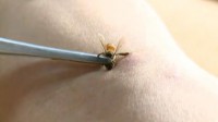 En Chine, les piqûres d'abeille en guise de thérapie de choc.