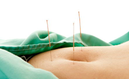 Acupuncture permet de maigrir