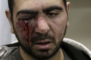 Blessé lors des manifestations au Bahreïn Blessé lors des manifestations au Bahreïn